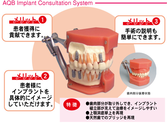 メリットは患者が獲得でき、患者様にインプラントを具体的にイメージさせられ手術の説明も簡単にできます、